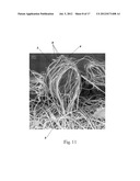 TUFTED FIBROUS WEB diagram and image