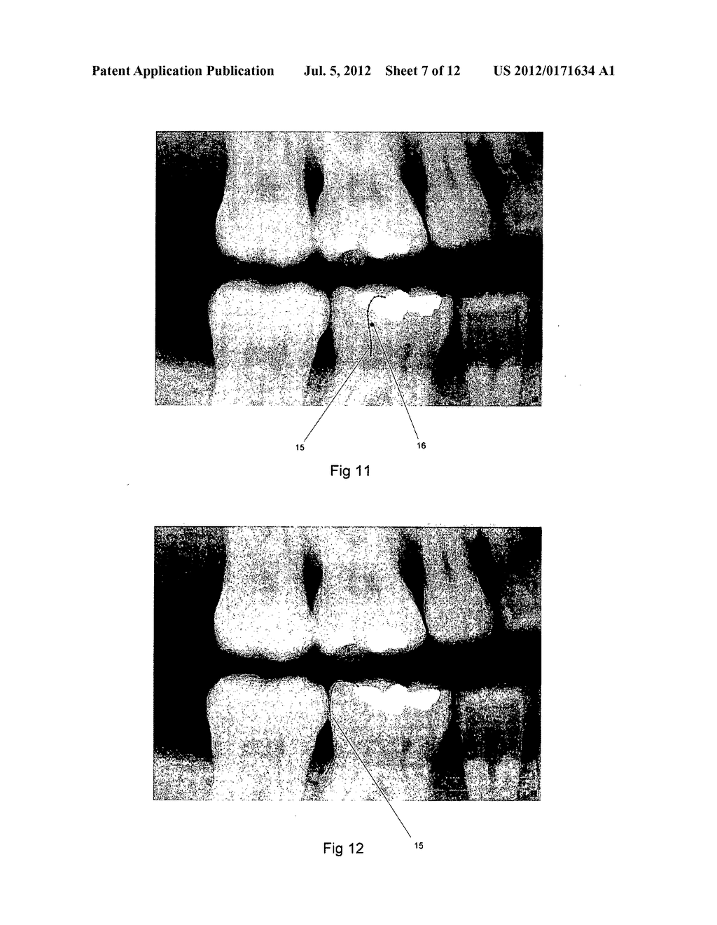 IMAGE ANALYSIS METHOD - diagram, schematic, and image 08