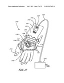 THERMALLY ASSISTED PULSED ELECTRO-MAGNETIC FIELD STIMULATION DEVICE AND     METHOD FOR TREATMENT OF OSTEOARTHRITIS diagram and image