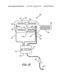 THERMALLY ASSISTED PULSED ELECTRO-MAGNETIC FIELD STIMULATION DEVICE AND     METHOD FOR TREATMENT OF OSTEOARTHRITIS diagram and image