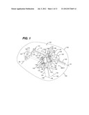 Retractor Component System And Method Comprising Same diagram and image