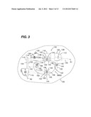 Retractor Component System And Method Comprising Same diagram and image