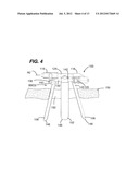 Retractor Component System And Method Comprising Same diagram and image