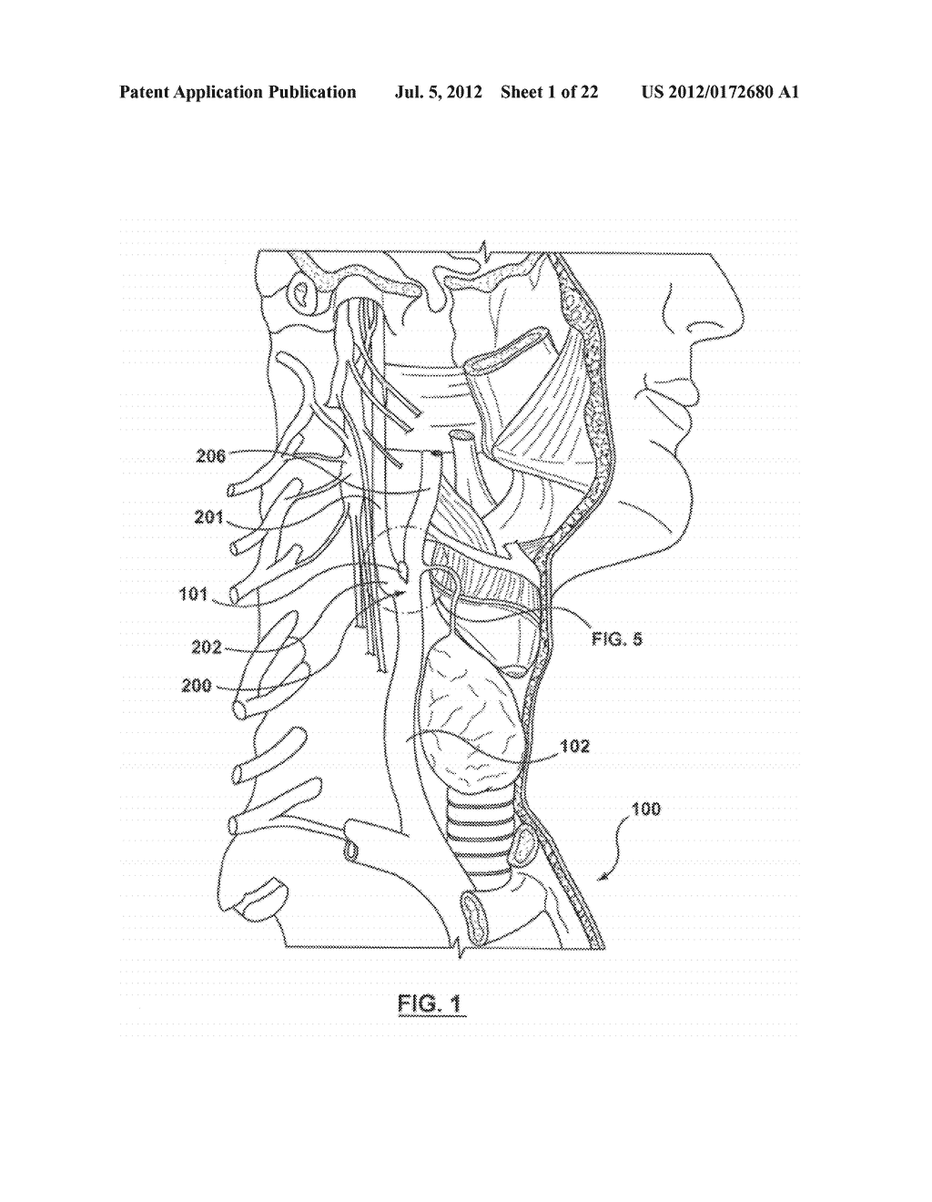 METHOD FOR SYMPATHETIC REBALANCING OF PATIENT - diagram, schematic, and image 02