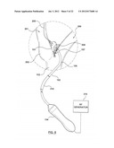 METHOD FOR SYMPATHETIC REBALANCING OF PATIENT diagram and image