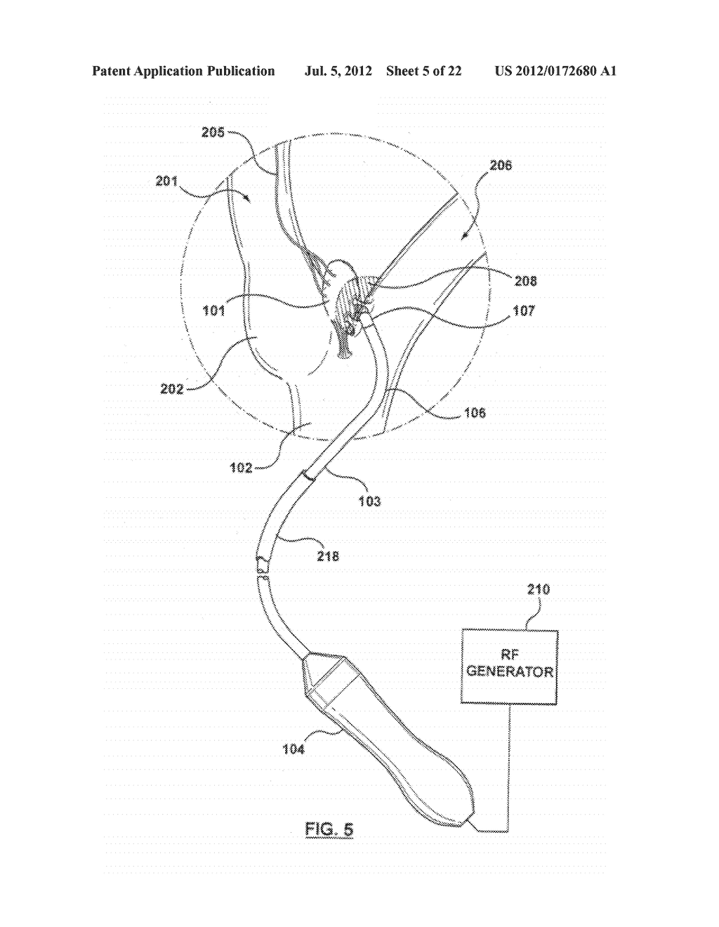 METHOD FOR SYMPATHETIC REBALANCING OF PATIENT - diagram, schematic, and image 06
