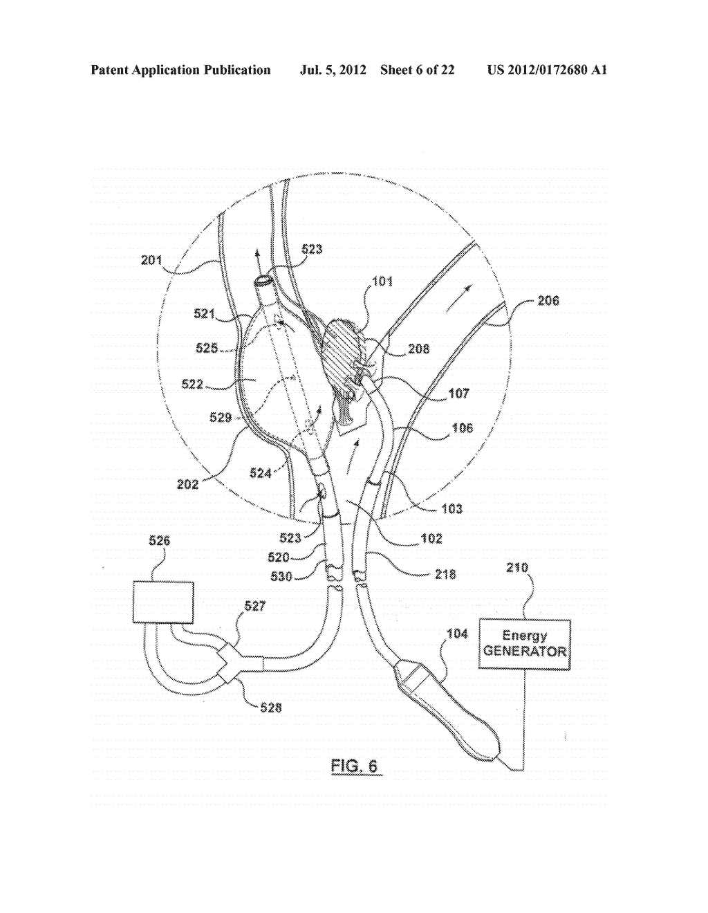 METHOD FOR SYMPATHETIC REBALANCING OF PATIENT - diagram, schematic, and image 07