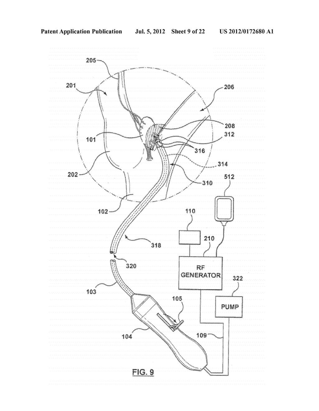 METHOD FOR SYMPATHETIC REBALANCING OF PATIENT - diagram, schematic, and image 10