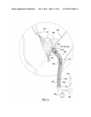 METHOD FOR SYMPATHETIC REBALANCING OF PATIENT diagram and image