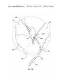 METHOD FOR SYMPATHETIC REBALANCING OF PATIENT diagram and image