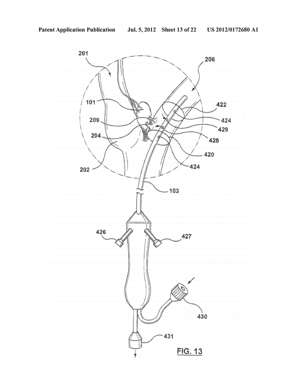 METHOD FOR SYMPATHETIC REBALANCING OF PATIENT - diagram, schematic, and image 14
