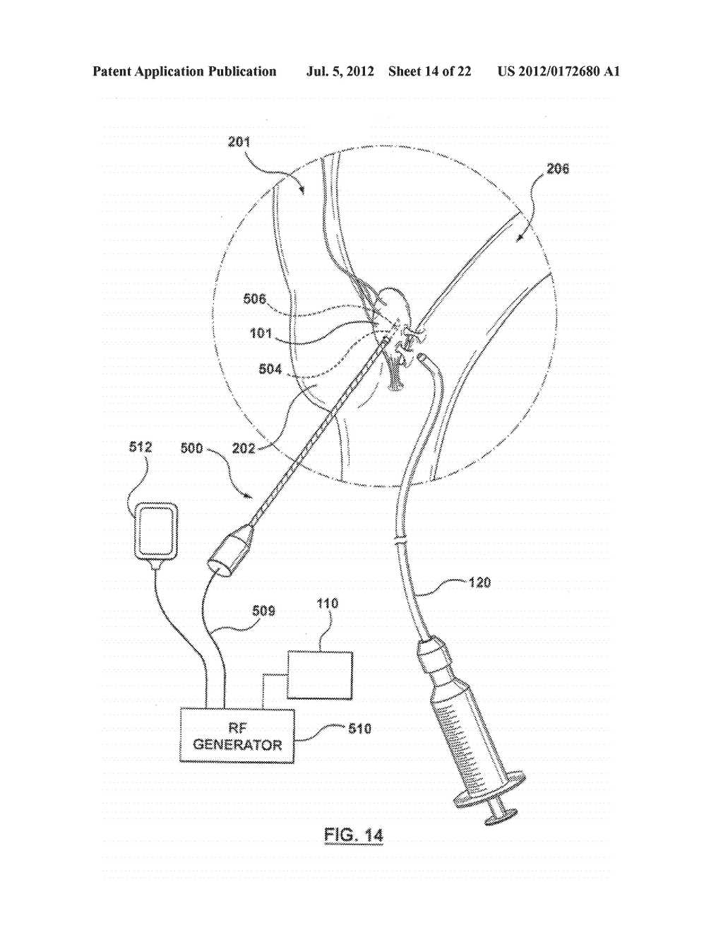 METHOD FOR SYMPATHETIC REBALANCING OF PATIENT - diagram, schematic, and image 15