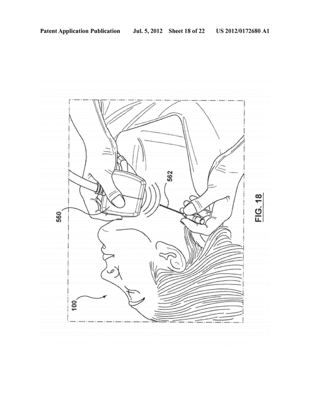 METHOD FOR SYMPATHETIC REBALANCING OF PATIENT - diagram, schematic, and image 19