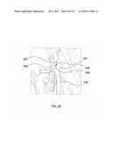 METHOD FOR SYMPATHETIC REBALANCING OF PATIENT diagram and image