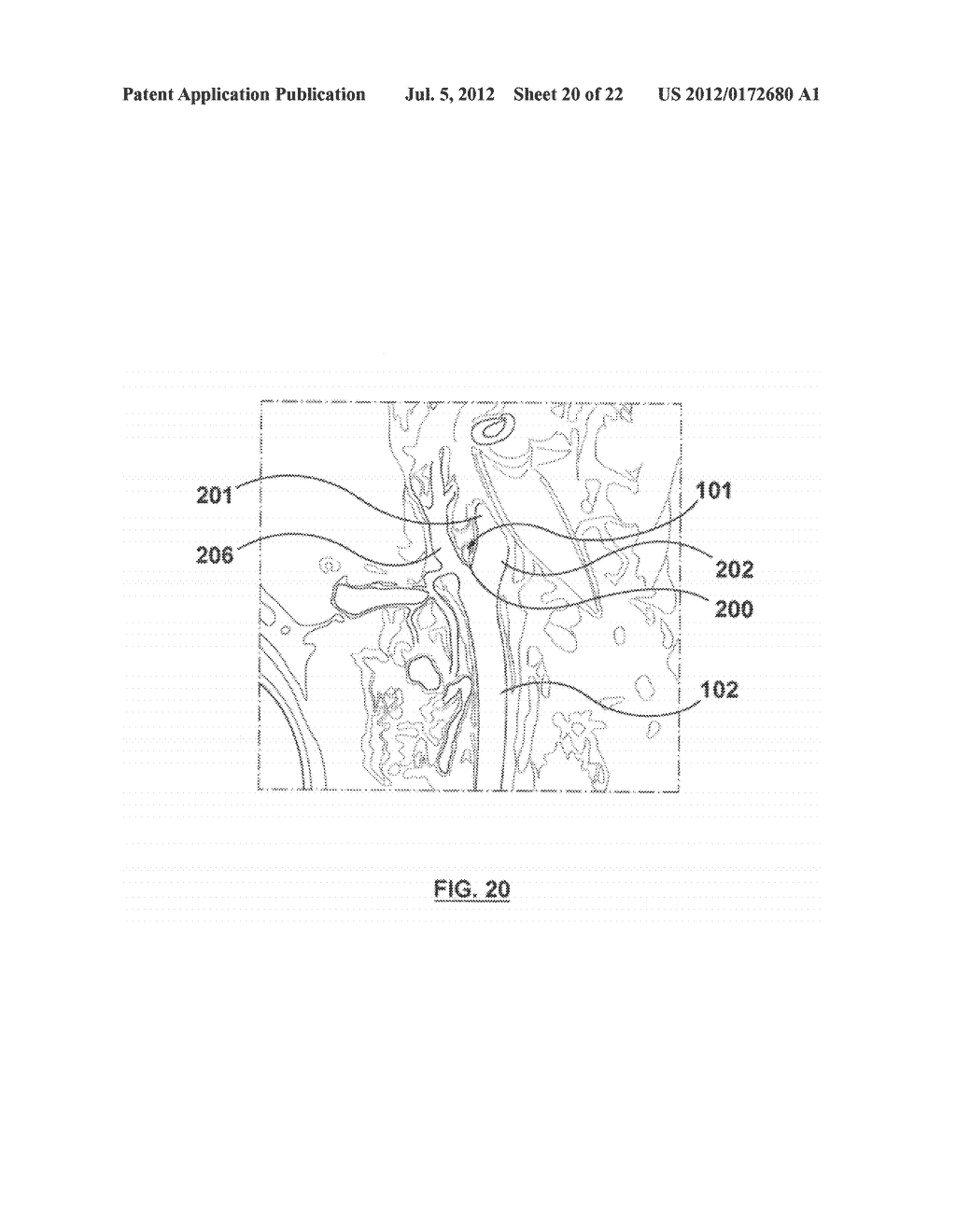 METHOD FOR SYMPATHETIC REBALANCING OF PATIENT - diagram, schematic, and image 21