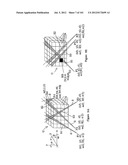 RADIOACTIVE-EMISSION-MEASUREMENT OPTIMIZATION TO SPECIFIC BODY STRUCTURES diagram and image