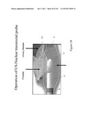 RADIOACTIVE-EMISSION-MEASUREMENT OPTIMIZATION TO SPECIFIC BODY STRUCTURES diagram and image