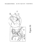 RADIOACTIVE-EMISSION-MEASUREMENT OPTIMIZATION TO SPECIFIC BODY STRUCTURES diagram and image