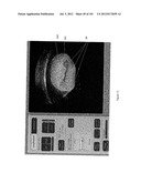 RADIOACTIVE-EMISSION-MEASUREMENT OPTIMIZATION TO SPECIFIC BODY STRUCTURES diagram and image