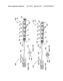 RADIOACTIVE-EMISSION-MEASUREMENT OPTIMIZATION TO SPECIFIC BODY STRUCTURES diagram and image