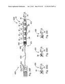 RADIOACTIVE-EMISSION-MEASUREMENT OPTIMIZATION TO SPECIFIC BODY STRUCTURES diagram and image