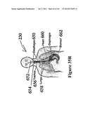 RADIOACTIVE-EMISSION-MEASUREMENT OPTIMIZATION TO SPECIFIC BODY STRUCTURES diagram and image