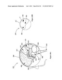 RADIOACTIVE-EMISSION-MEASUREMENT OPTIMIZATION TO SPECIFIC BODY STRUCTURES diagram and image