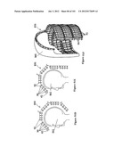 RADIOACTIVE-EMISSION-MEASUREMENT OPTIMIZATION TO SPECIFIC BODY STRUCTURES diagram and image