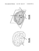 METHOD FOR DEVELOPING AN INFORMATION PREDICTION DEVICE, USE THEREOF, AND     CORRESPONDING STORAGE MEDIUM AND APPARATUS diagram and image