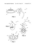 Injectable Vascular Access Port with Discernable Markers for     Identification diagram and image