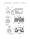 Injectable Vascular Access Port with Discernable Markers for     Identification diagram and image