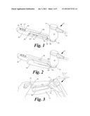 ULTRASOUND APPARATUS AND GRAPHICAL INTERFACE FOR PROCEDURAL ASSISTANCE diagram and image