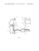 DEVICE AND METHOD OF AUTOMATIC CALIBRATION OF A TENSOR IN ARTHROPLASTY     PROCEDURES diagram and image