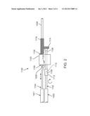 TISSUE REMOVAL SYSTEM diagram and image