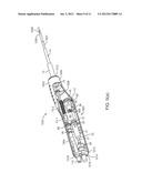 TISSUE REMOVAL SYSTEM diagram and image