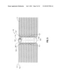 WOUND CLOSURE DEVICE INCLUDING PROGRIP STRAW diagram and image