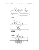 APPARATUS AND METHOD FOR SEALING A VESSEL PUNCTURE OPENING diagram and image