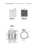 APPARATUS AND METHOD FOR SEALING A VESSEL PUNCTURE OPENING diagram and image