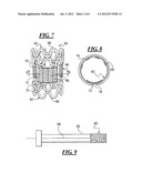 APPARATUS AND METHOD FOR SEALING A VESSEL PUNCTURE OPENING diagram and image