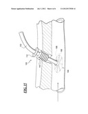 APPARATUS AND METHOD FOR SEALING A VESSEL PUNCTURE OPENING diagram and image