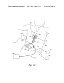 EXTENDED PAIN RELIEF VIA HIGH FREQUENCY SPINAL CORD MODULATION, AND     ASSOCIATED SYSTEMS AND METHODS diagram and image