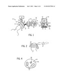 Microwave Hyperthermia Treatment System diagram and image