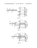 VERTEBRAL OSTEOSYNTHETIS EQUIPMENT diagram and image