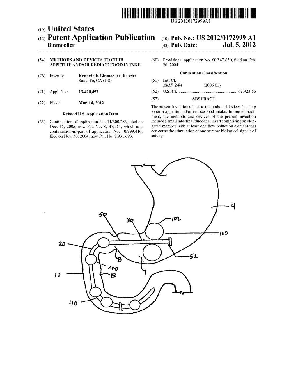 METHODS AND DEVICES TO CURB APPETITE AND/OR REDUCE FOOD INTAKE - diagram, schematic, and image 01