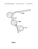 METHODS AND DEVICES TO CURB APPETITE AND/OR REDUCE FOOD INTAKE diagram and image