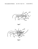 METHODS AND DEVICES TO CURB APPETITE AND/OR REDUCE FOOD INTAKE diagram and image