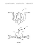 SWIMMING FROG LURE AND METHOD diagram and image