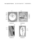 SPIN-AND-CLICK COMBINATION DIAL LOCK ASSEMBLY diagram and image