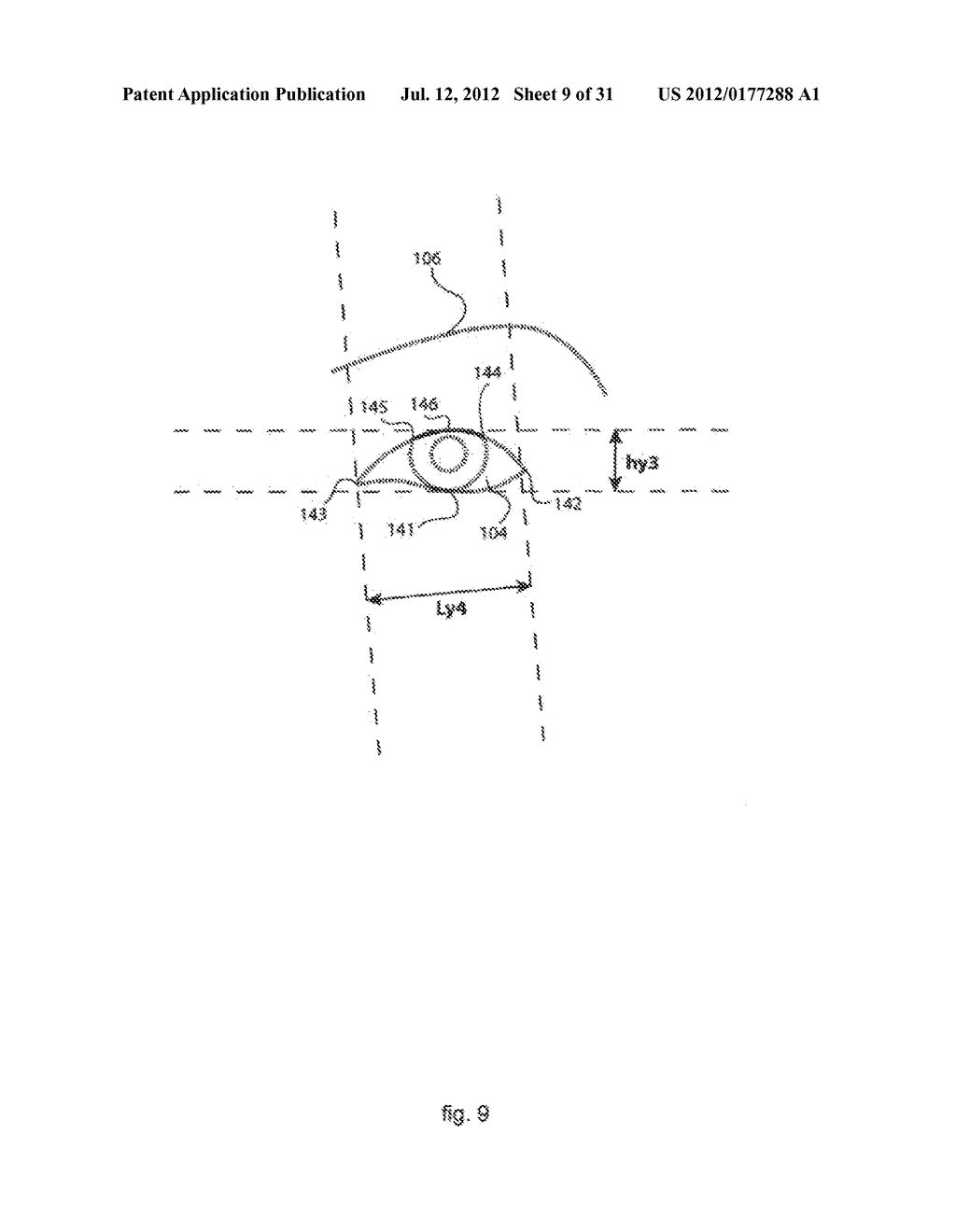 IMAGE-PROCESSING METHOD FOR CORRECTING A TARGET IMAGE WITH RESPECT TO A     REFERENCE IMAGE, AND CORRESPONDING IMAGE-PROCESSING DEVICE - diagram, schematic, and image 10