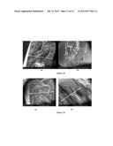 PROCESS FOR PRODUCING A CARBONACEOUS PRODUCT FROM BIOMASS diagram and image